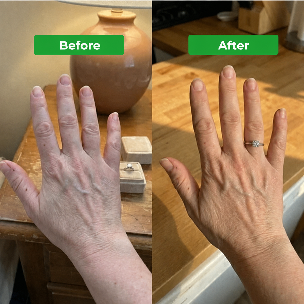 Lymphatic Drainage