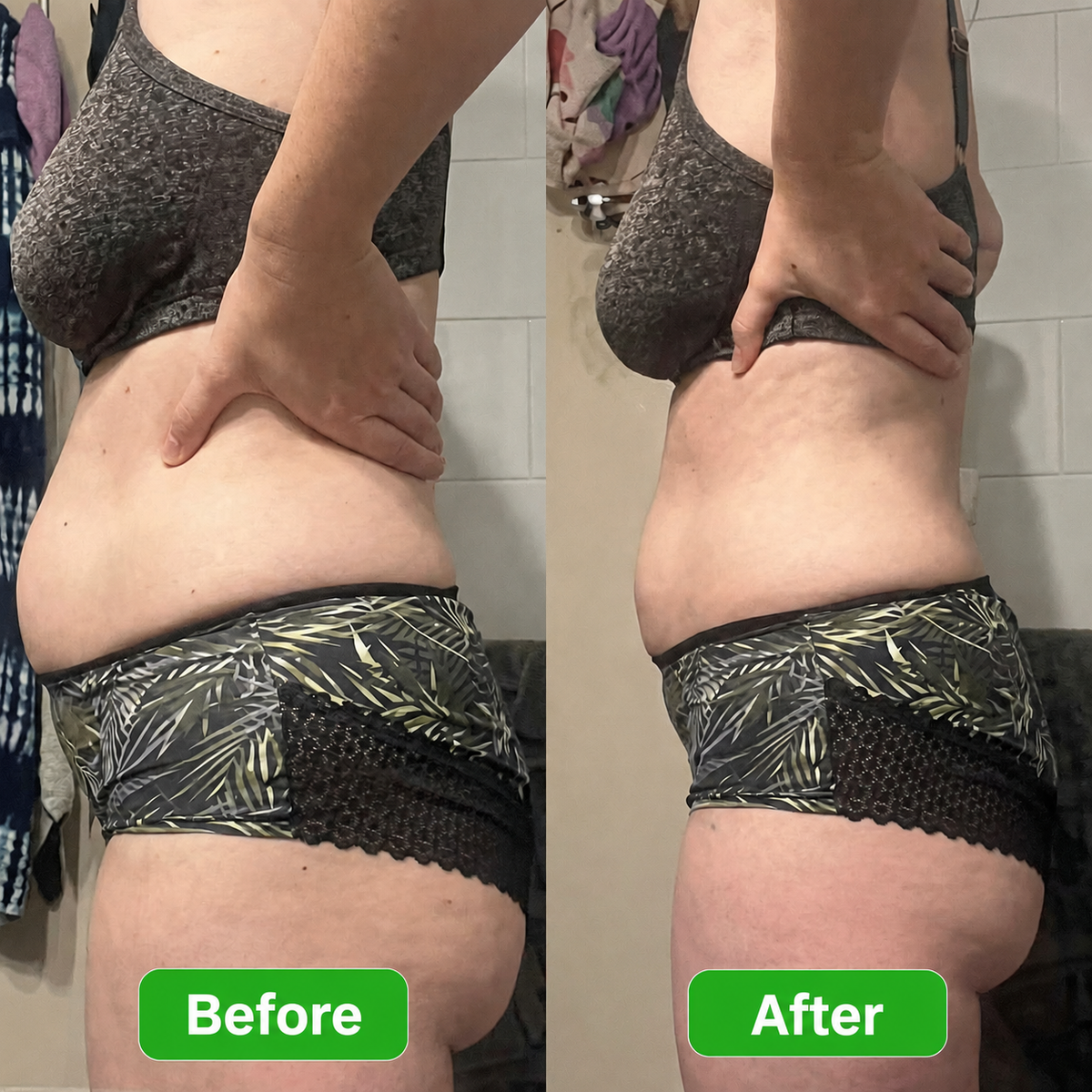 Lymphatic Drainage