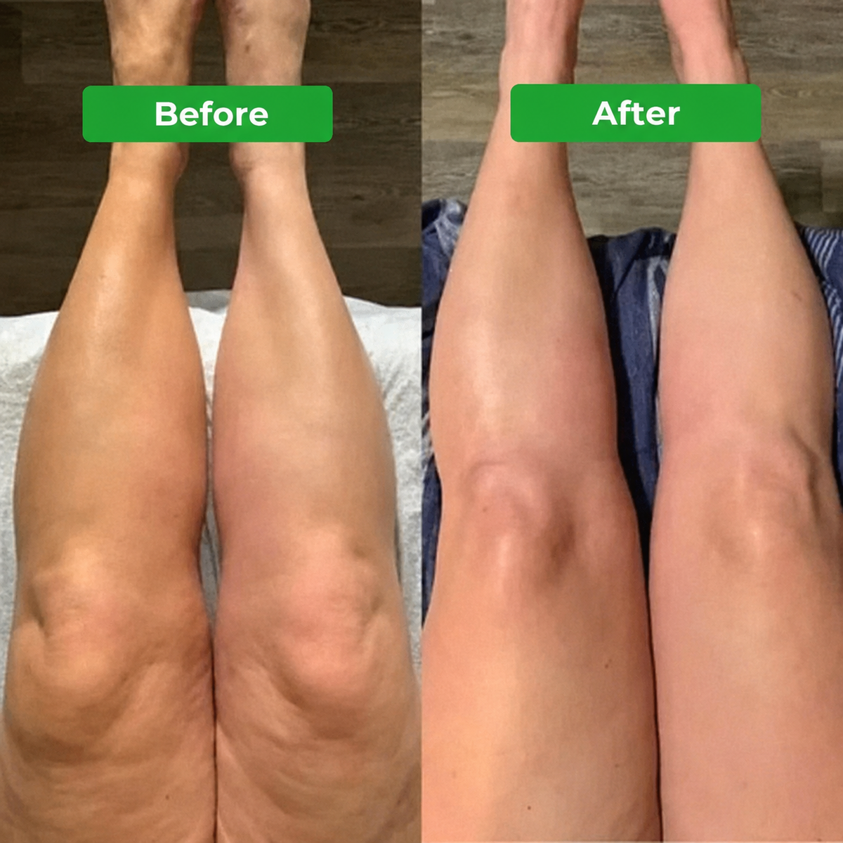 Lymphatic Drainage