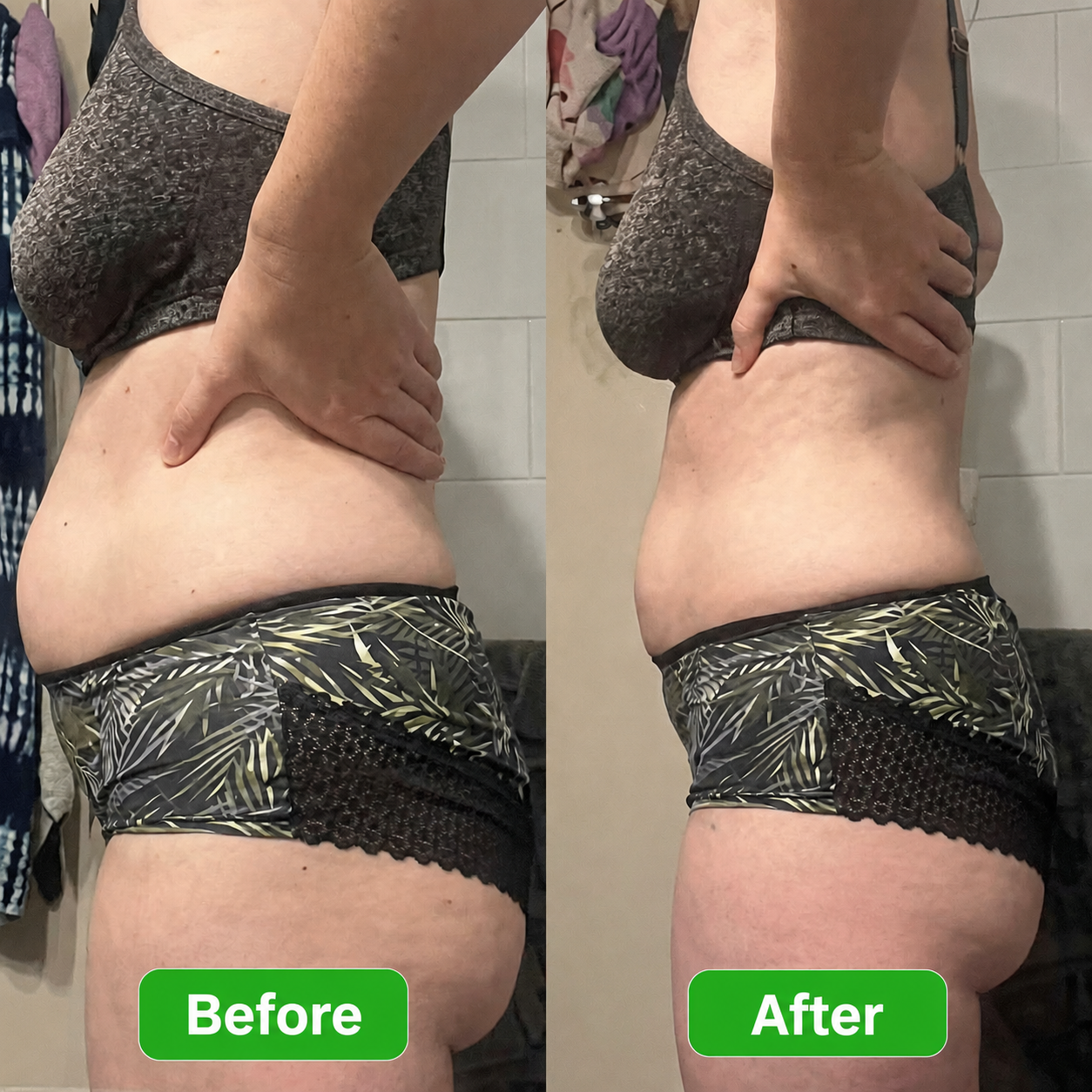 Lymphatic Drainage
